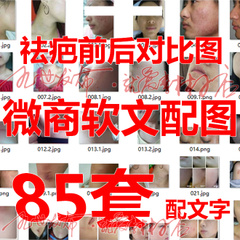85套 微商用图软文配图 祛疤对比图 配文字前后真实图片素材